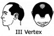 III Vertex